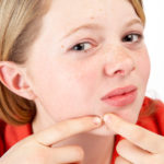 teen acne solutions