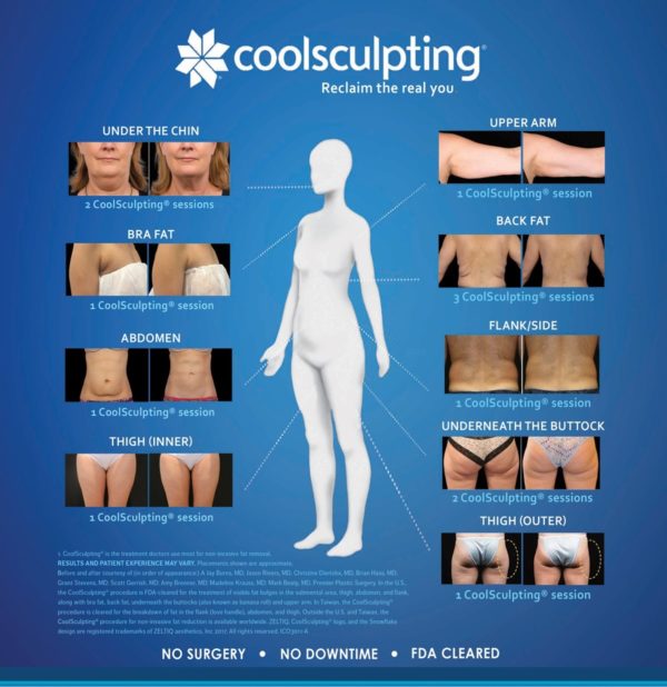 where does coolsculpting work