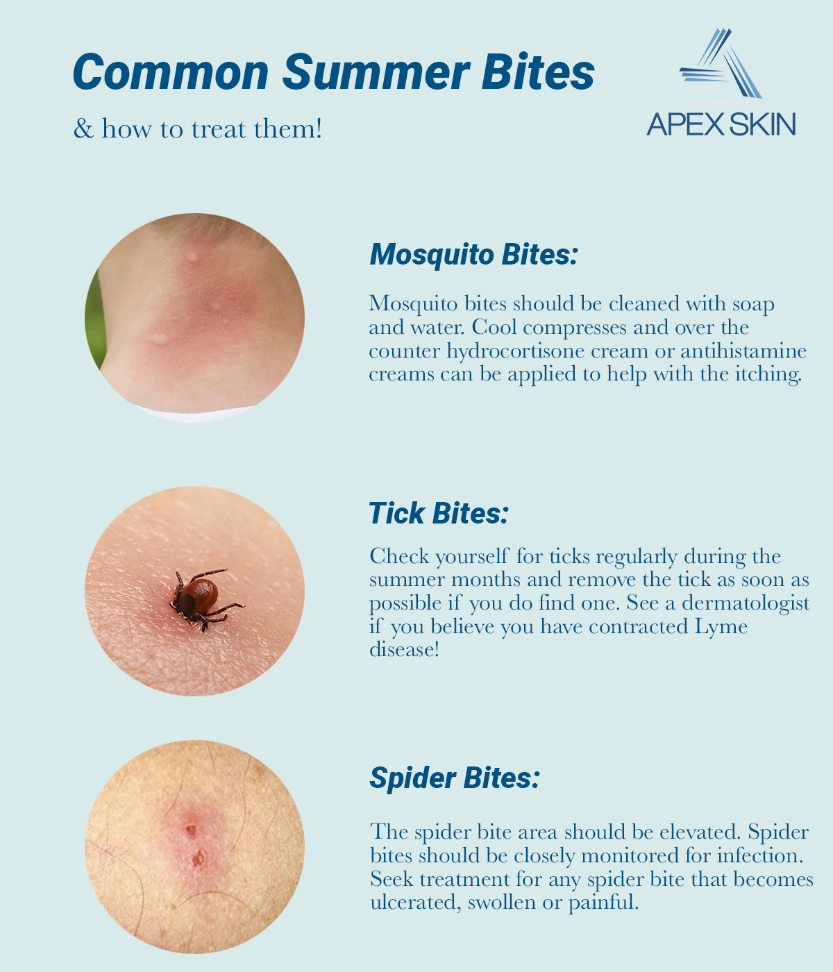 summer bites