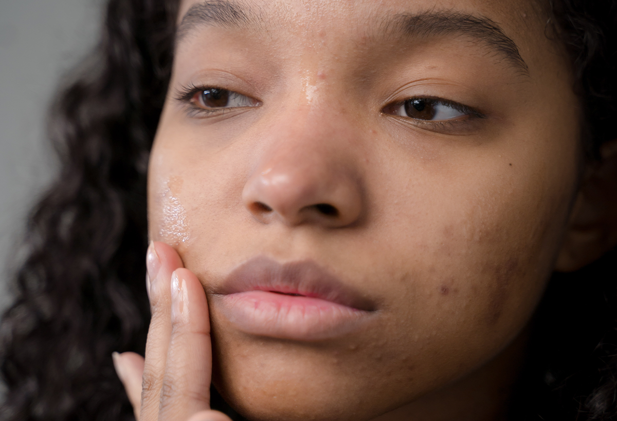 the link between skin health and mental health