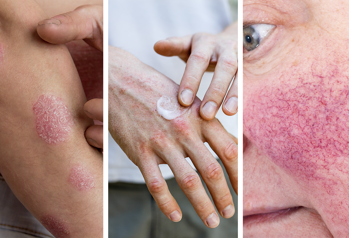 4 Most Common Skin Conditions the Experts Identify During a Skin Check