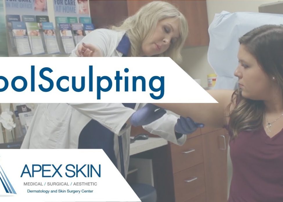 Coolsculpting Video