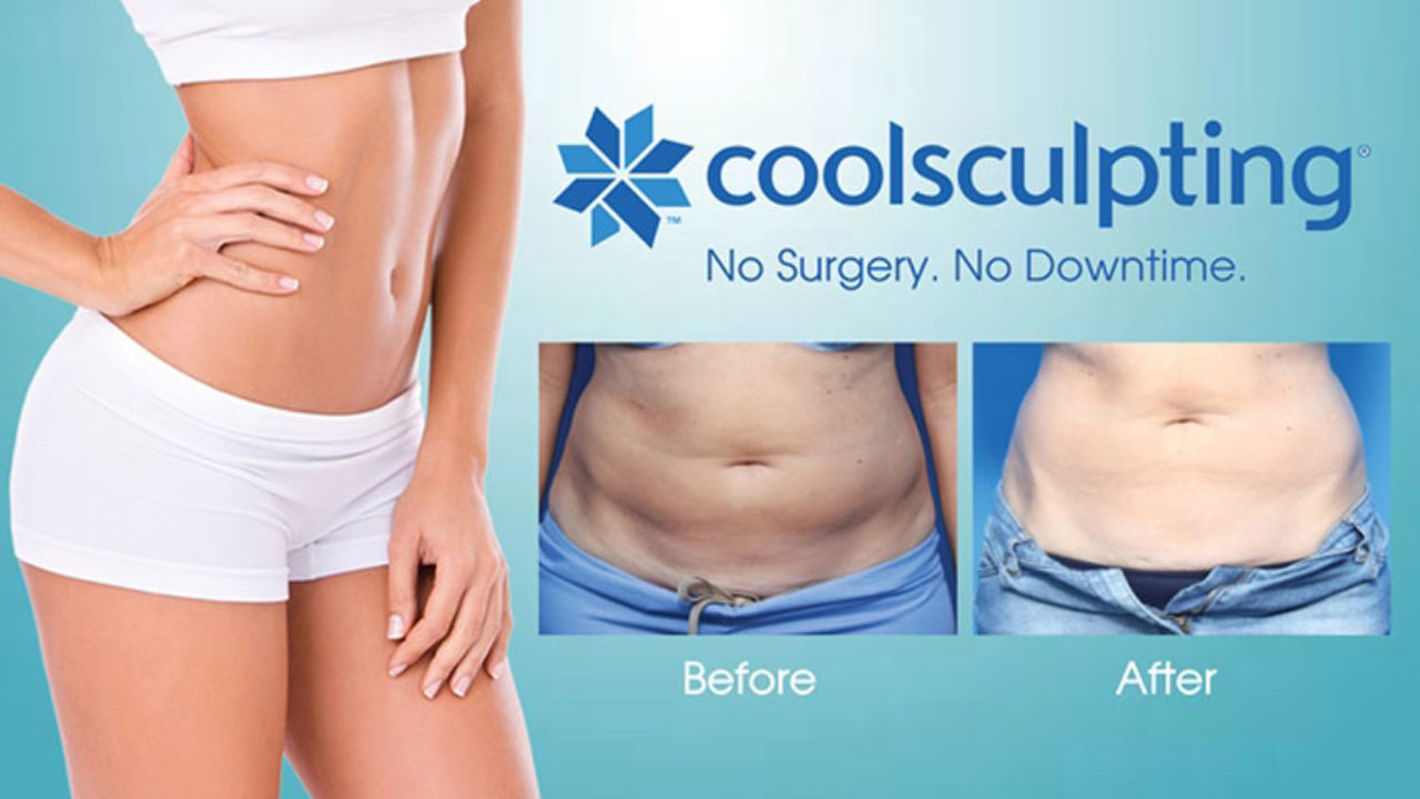 CoolSculpting: How to Prepare, Procedure, Cost, Before and After