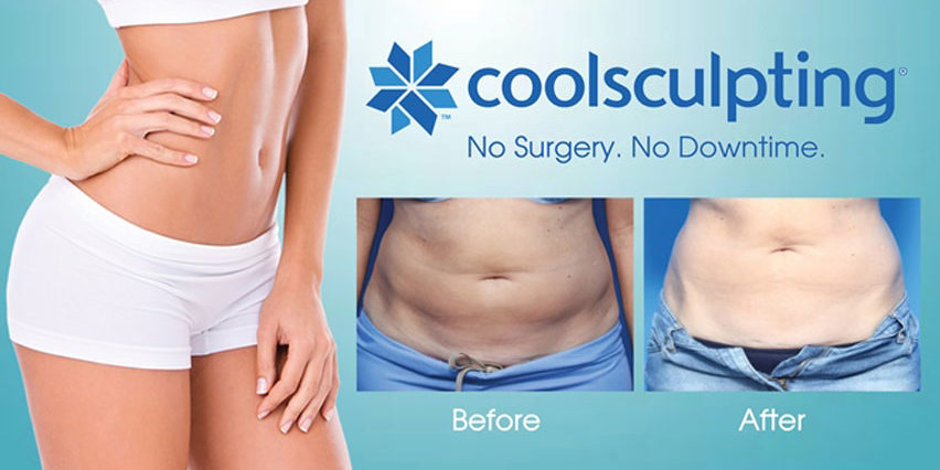 Coolsculpting Results - Before and After