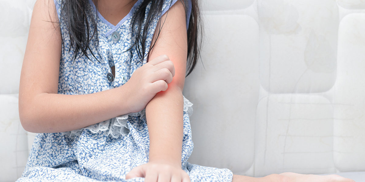 eczema in kids eczema in kids
