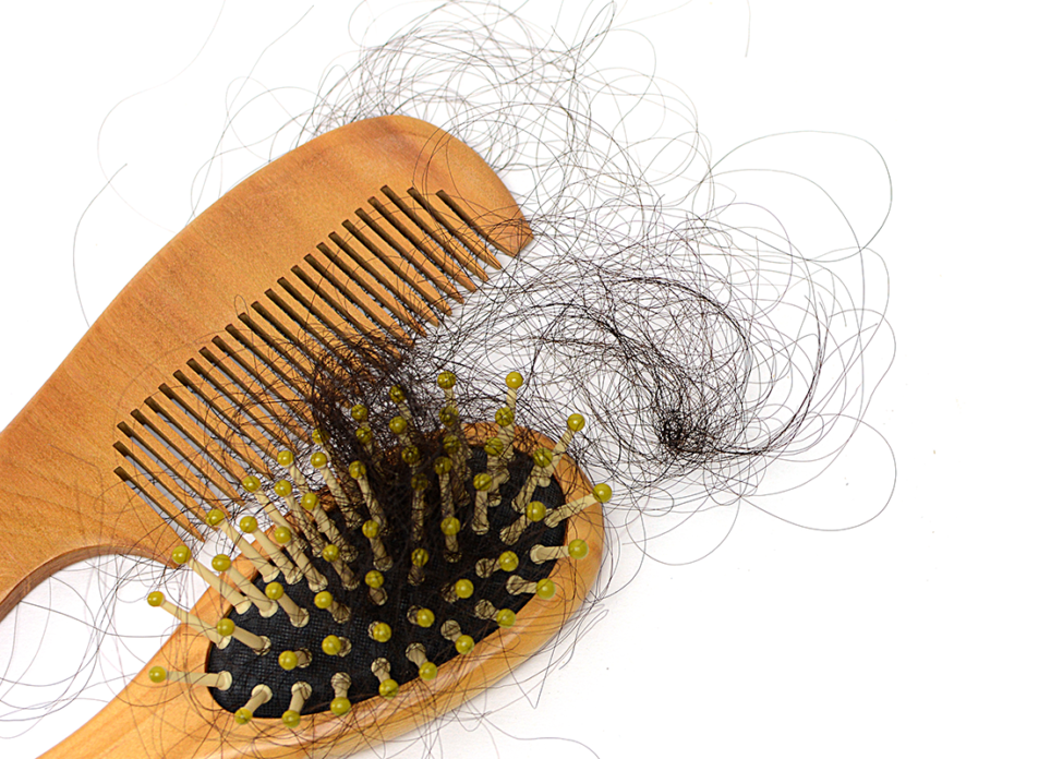 hair loss