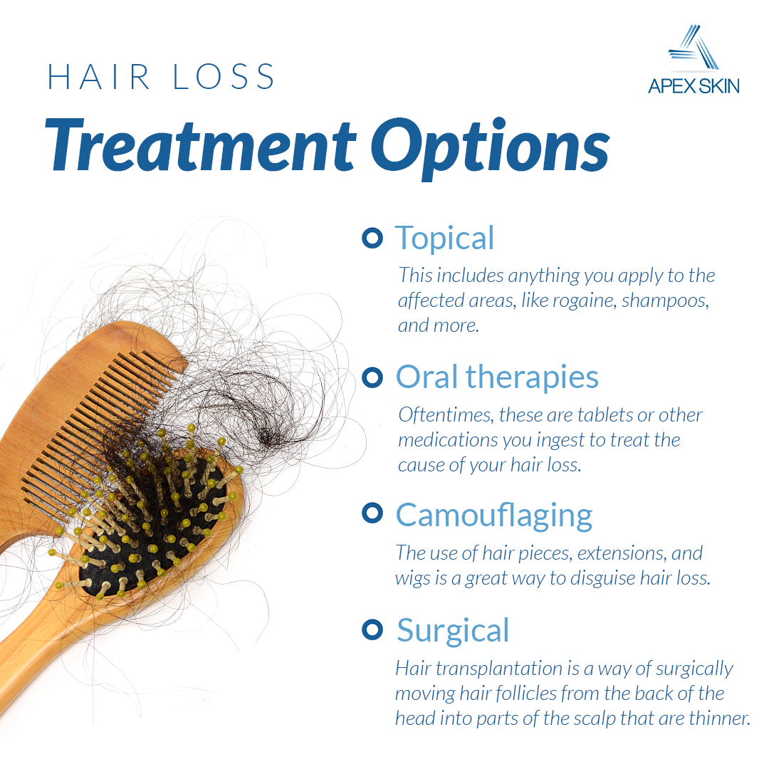 hair loss treatments