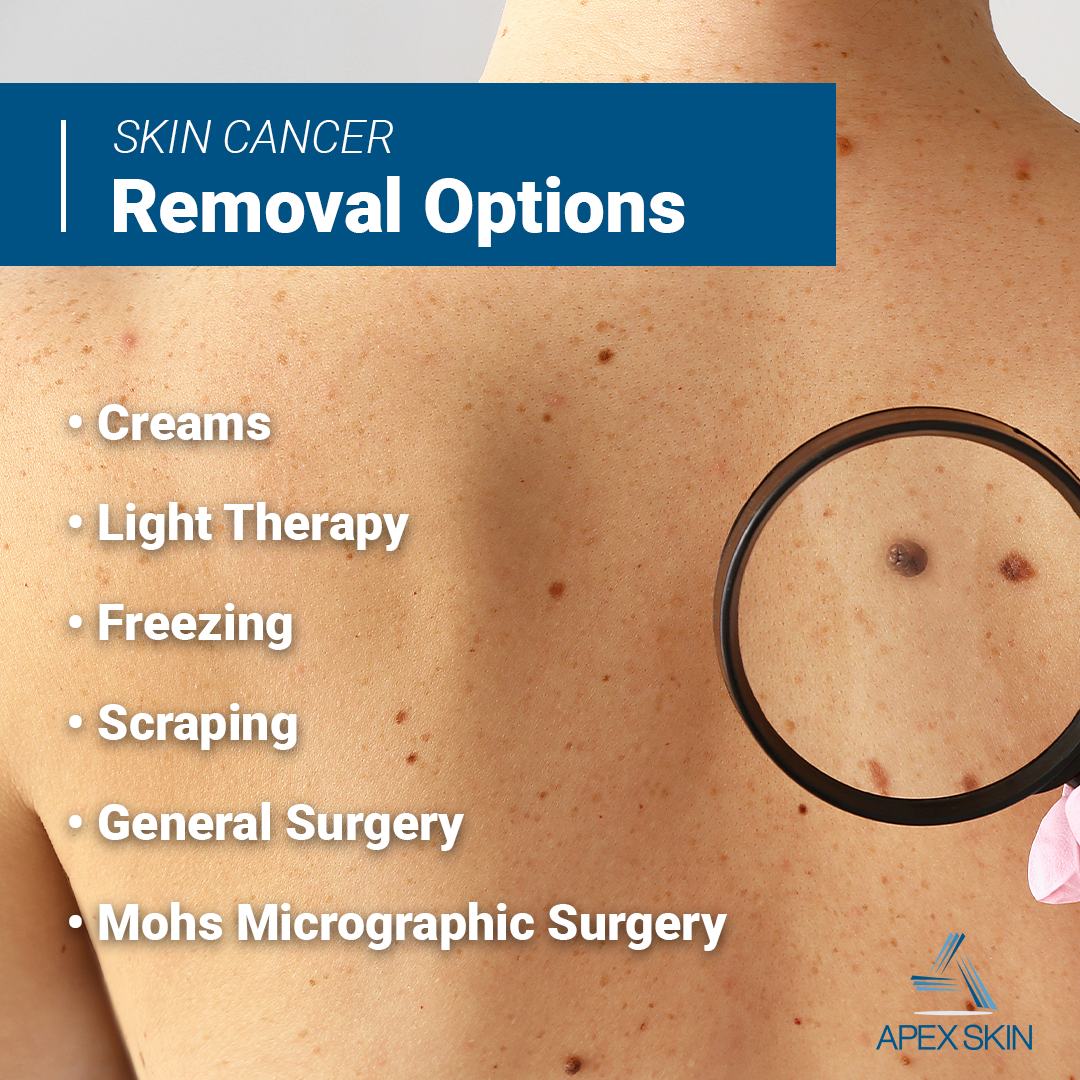 skin cancer removal skin cancer removal
