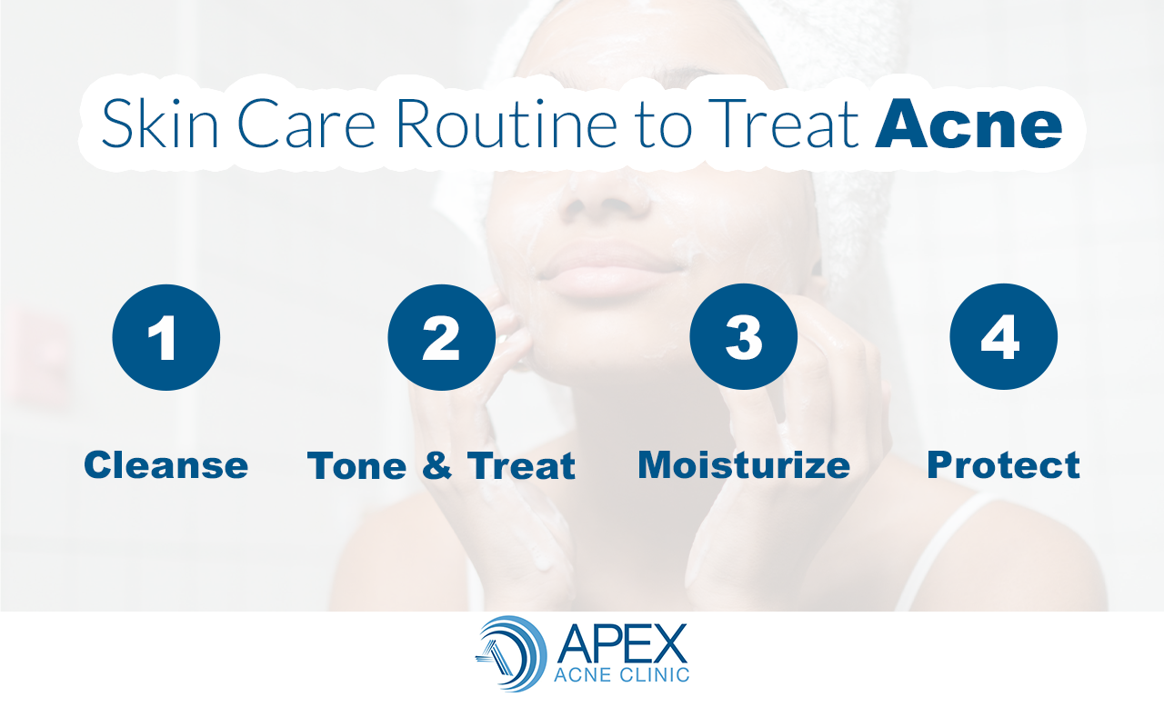 skin care for acne