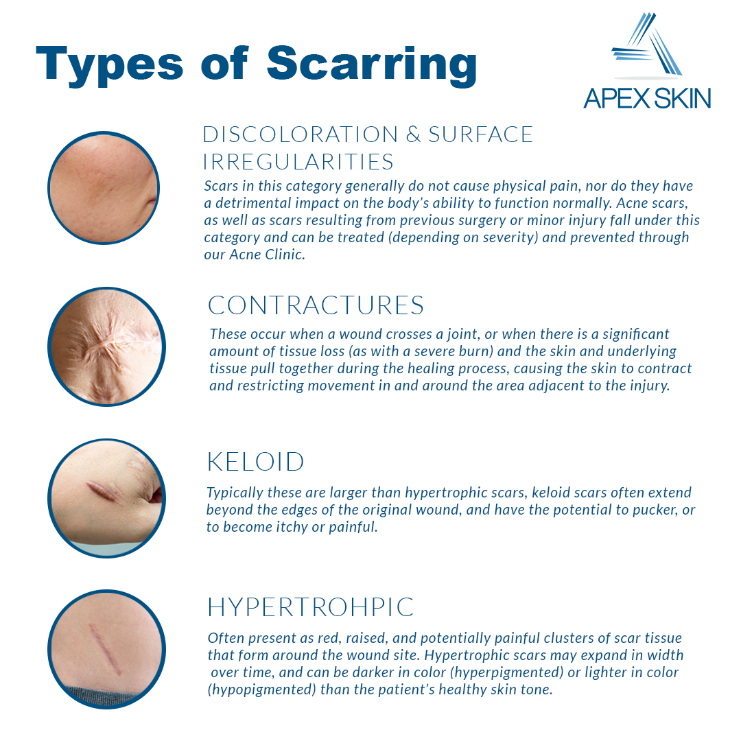 types of scarring