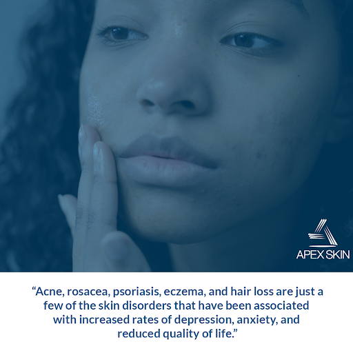 acne and mental health acne and mental health