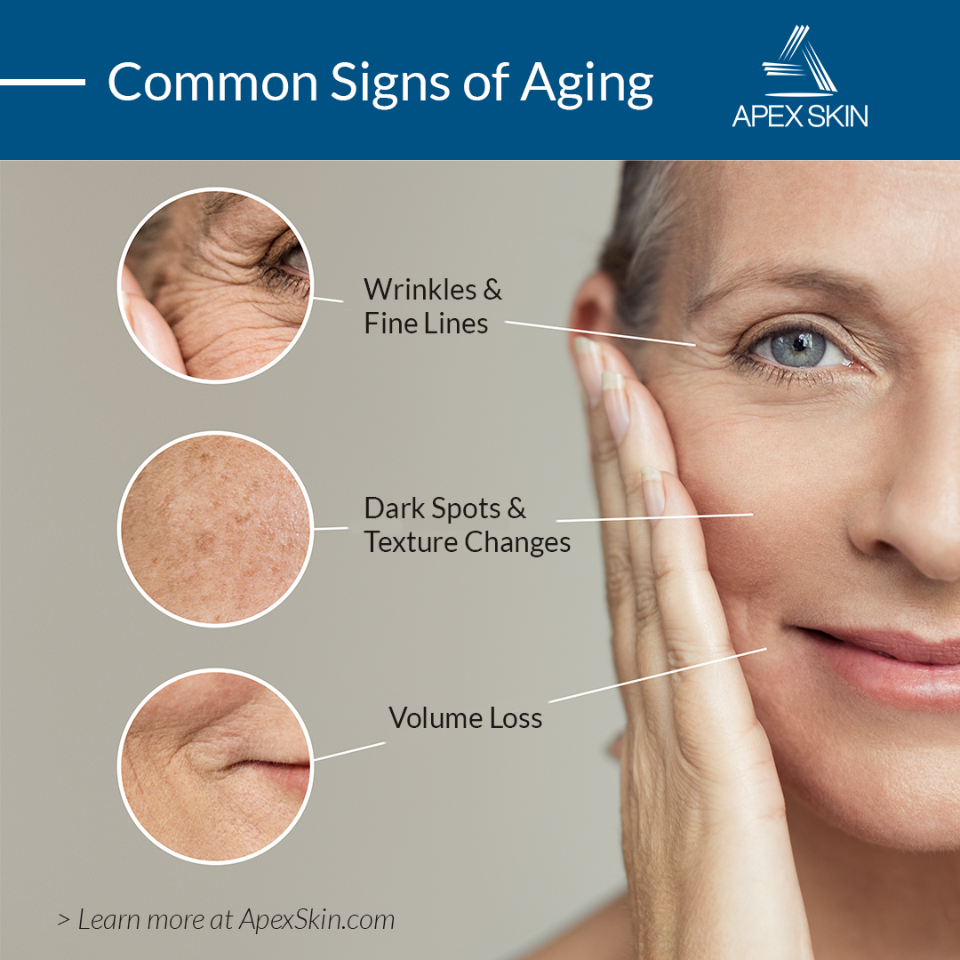 aging skin