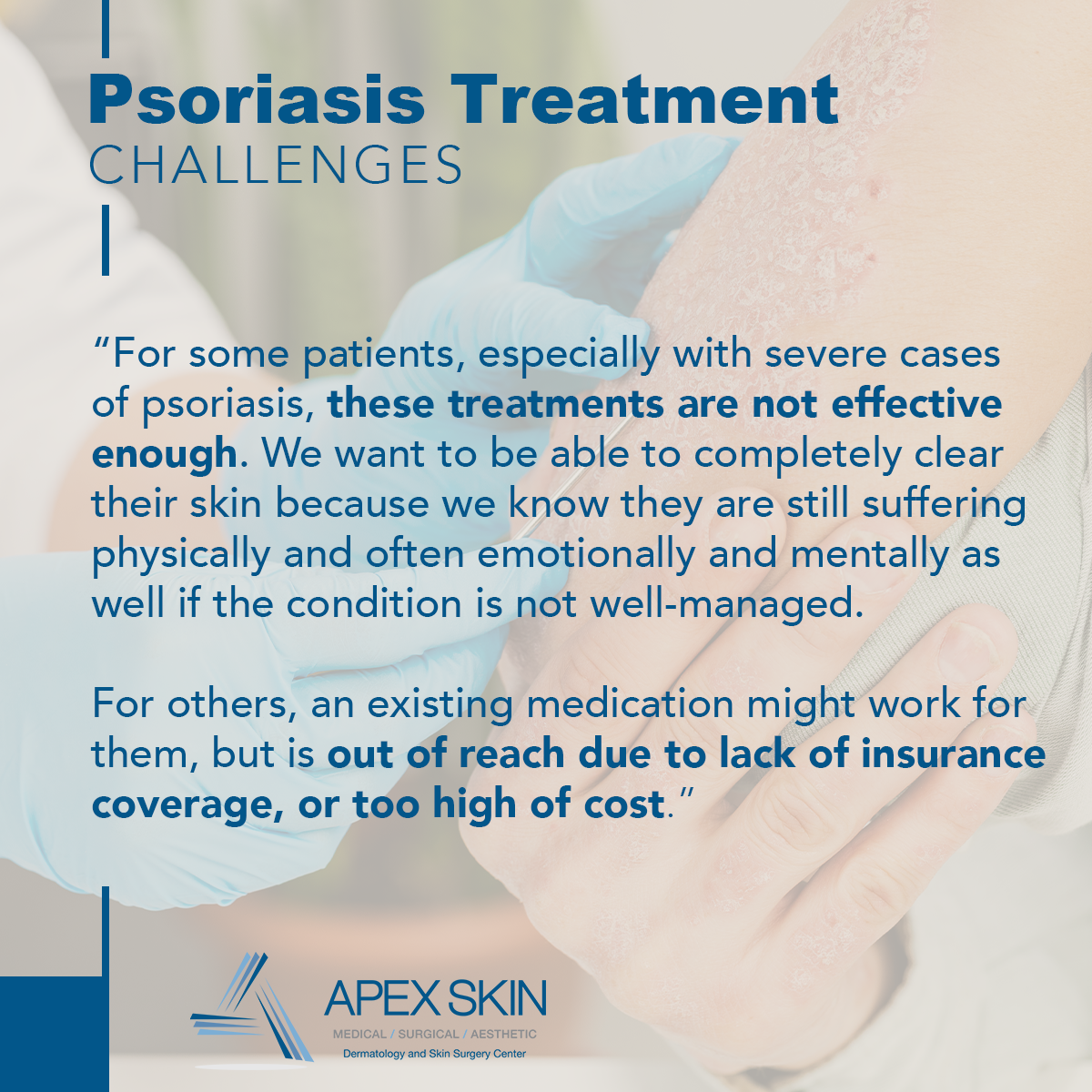 psoriasis treatment trials