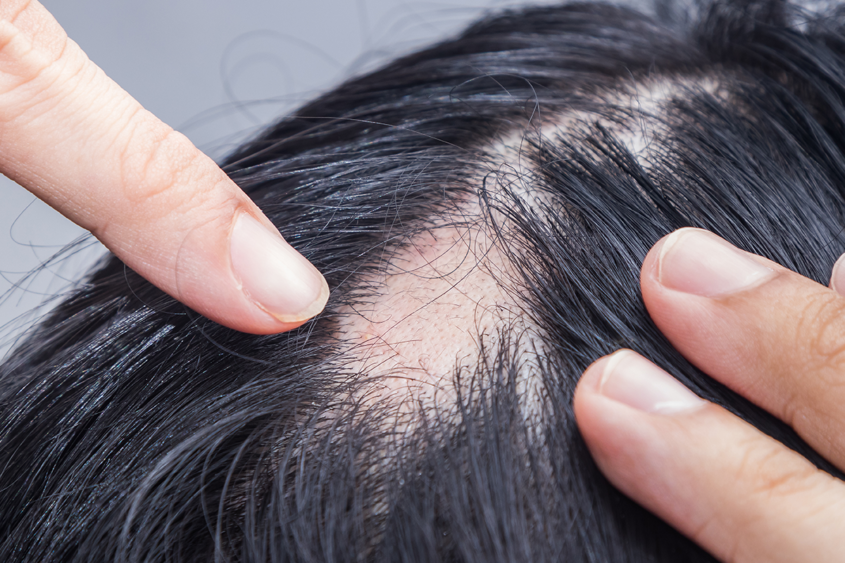 auto immune diseases