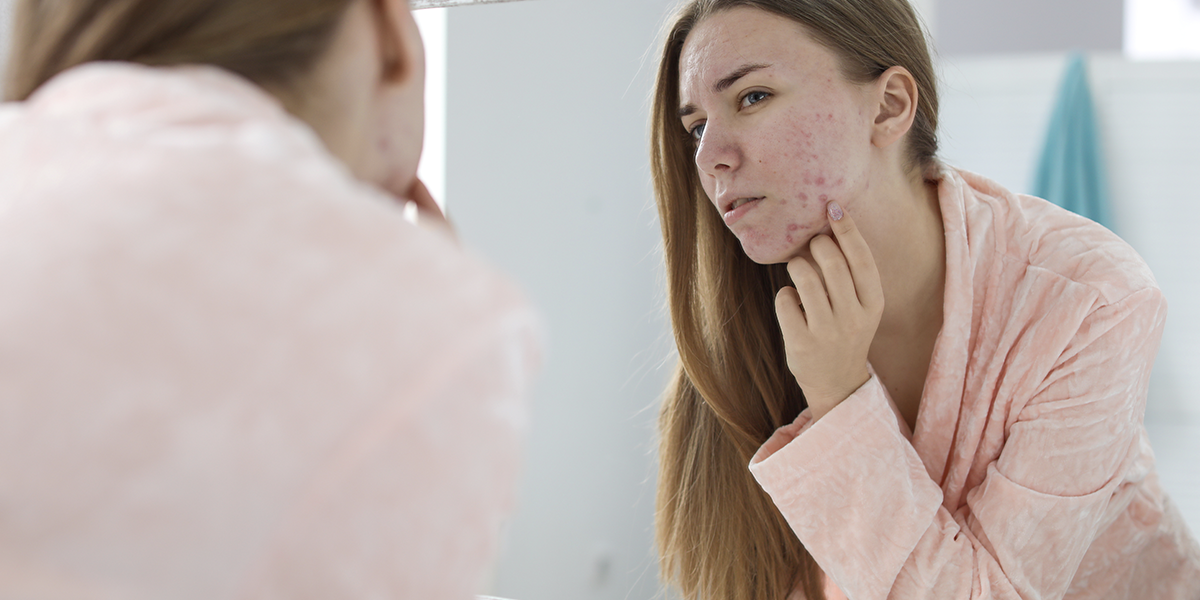 acne in winter