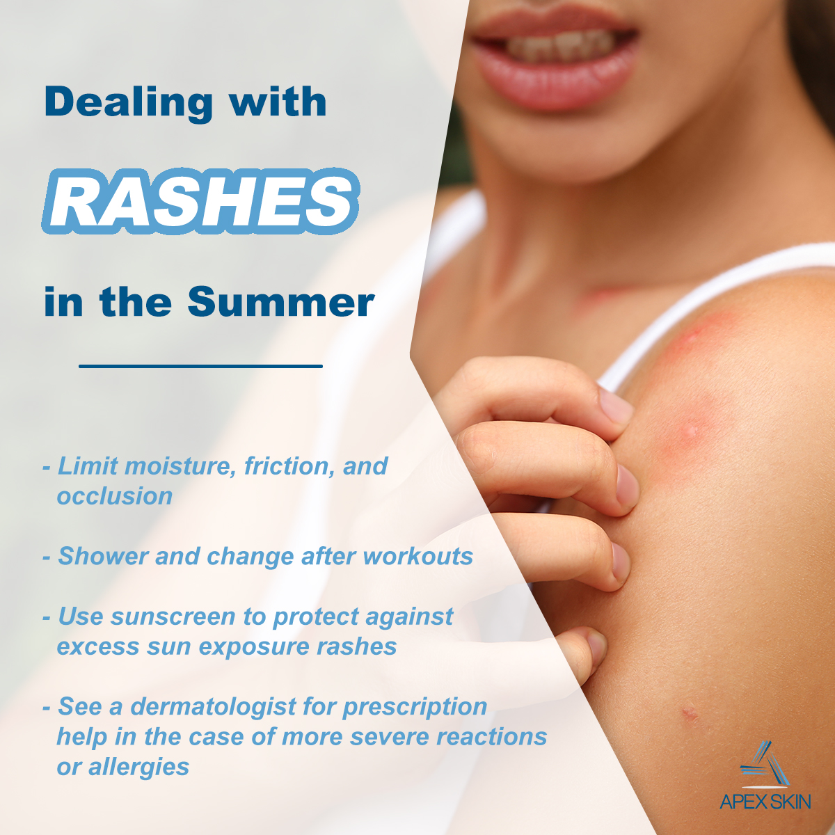rashes summer skin issues