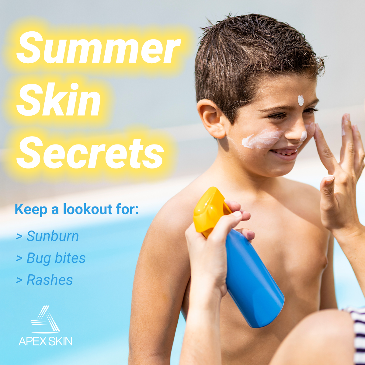 How to protect kids from sunburn