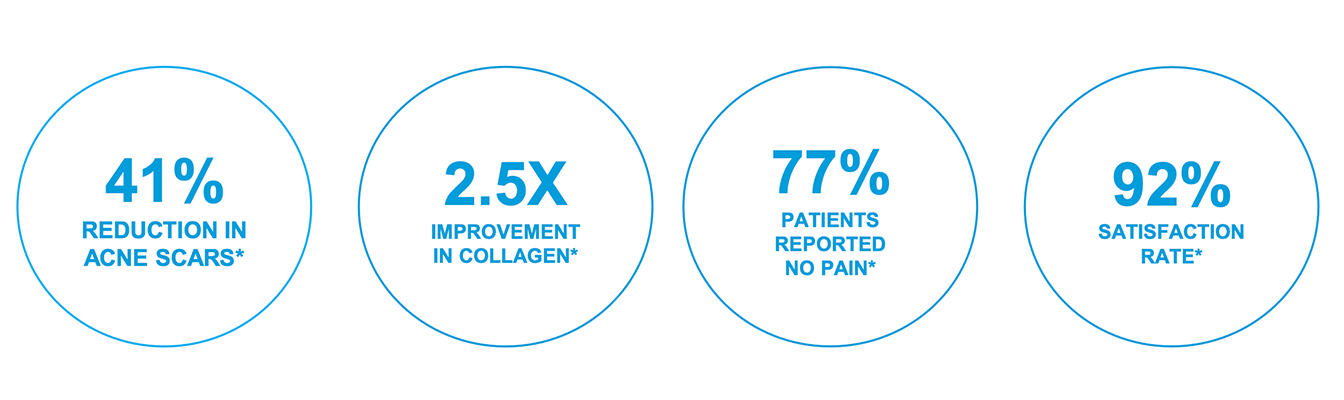 exion for face results