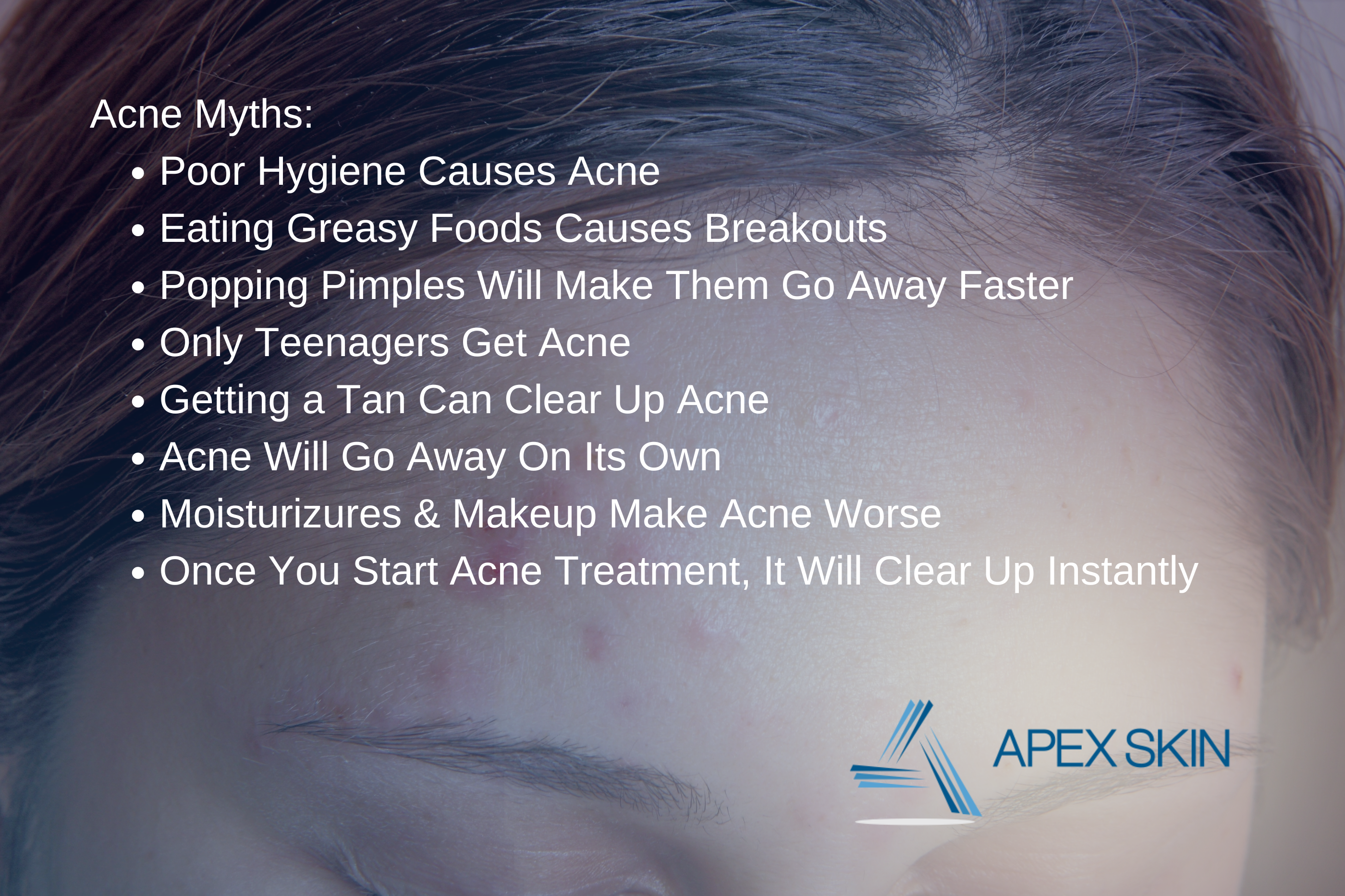 Acne Myths Acne myths