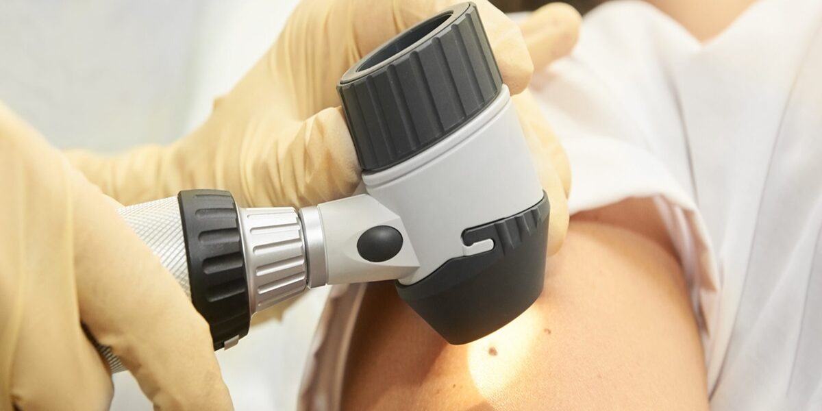 Check Mole At Hospital. Doctor Hands In Gloves. Special Equipmen