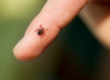 This person has a tick and needs to get it checked by a dermatologist.