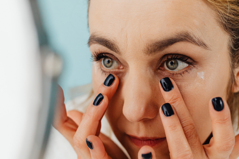 Woman using eye cream on under eye bags and dark circles.