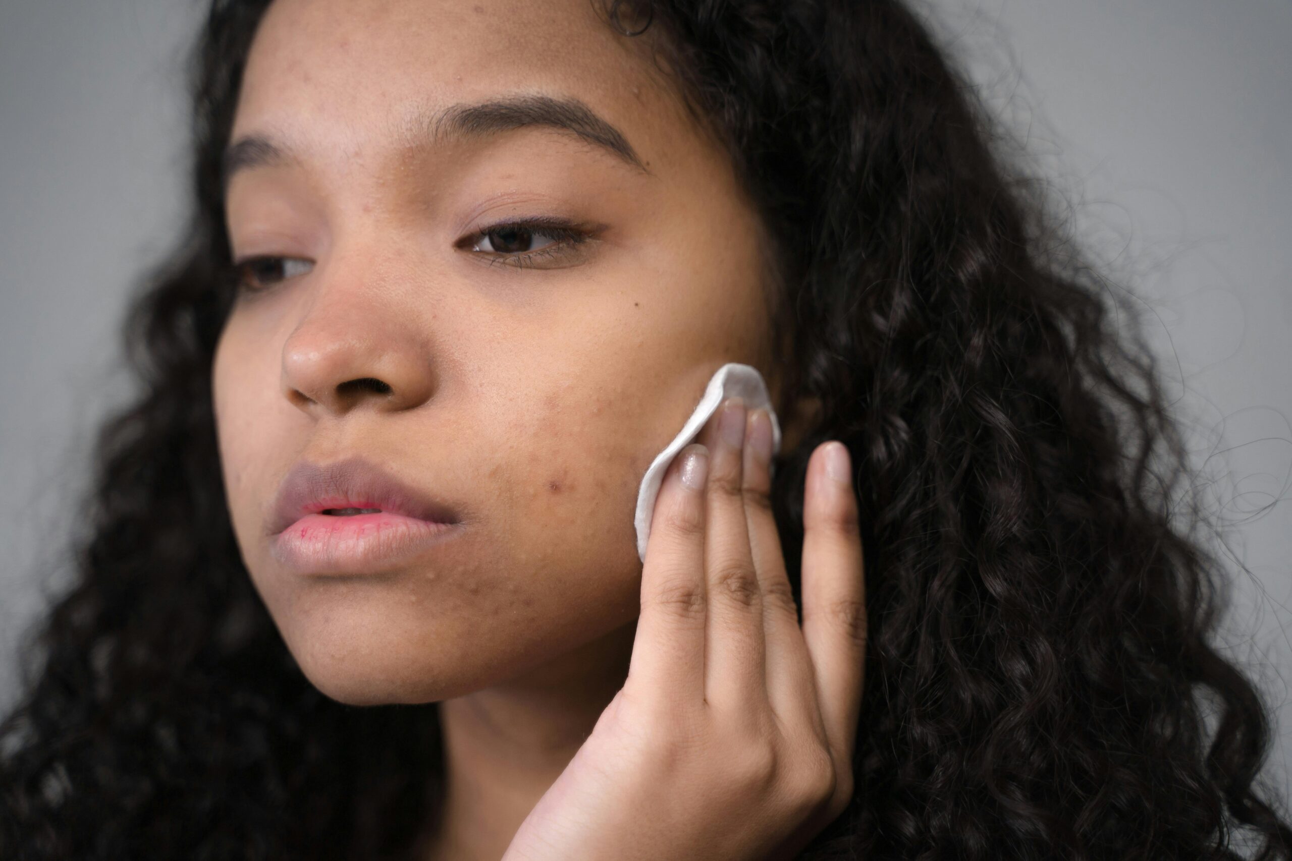Young person using cotton pad on face to address dry or oily skin.