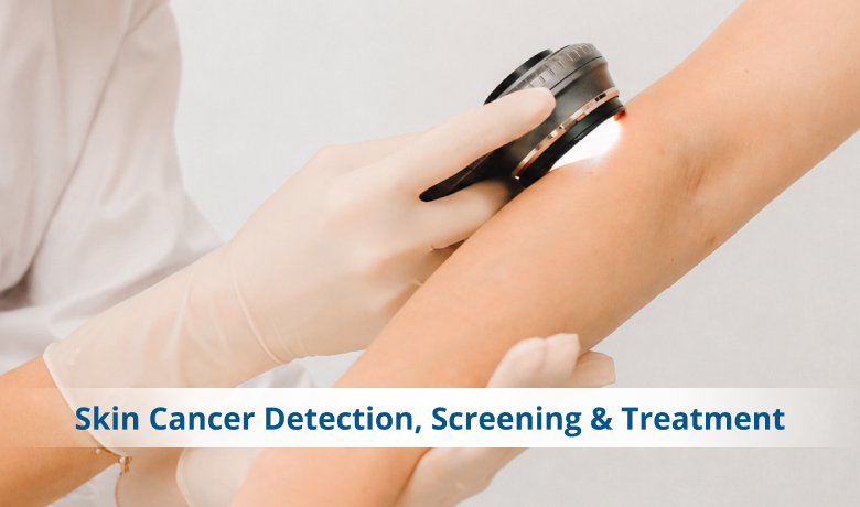 skin cancer