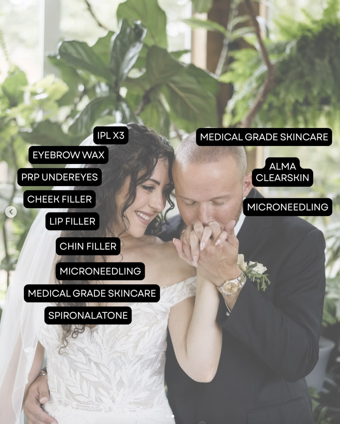 Tess Wedding Routine Skincare routine to prepare for wedding at Apex bride and groom