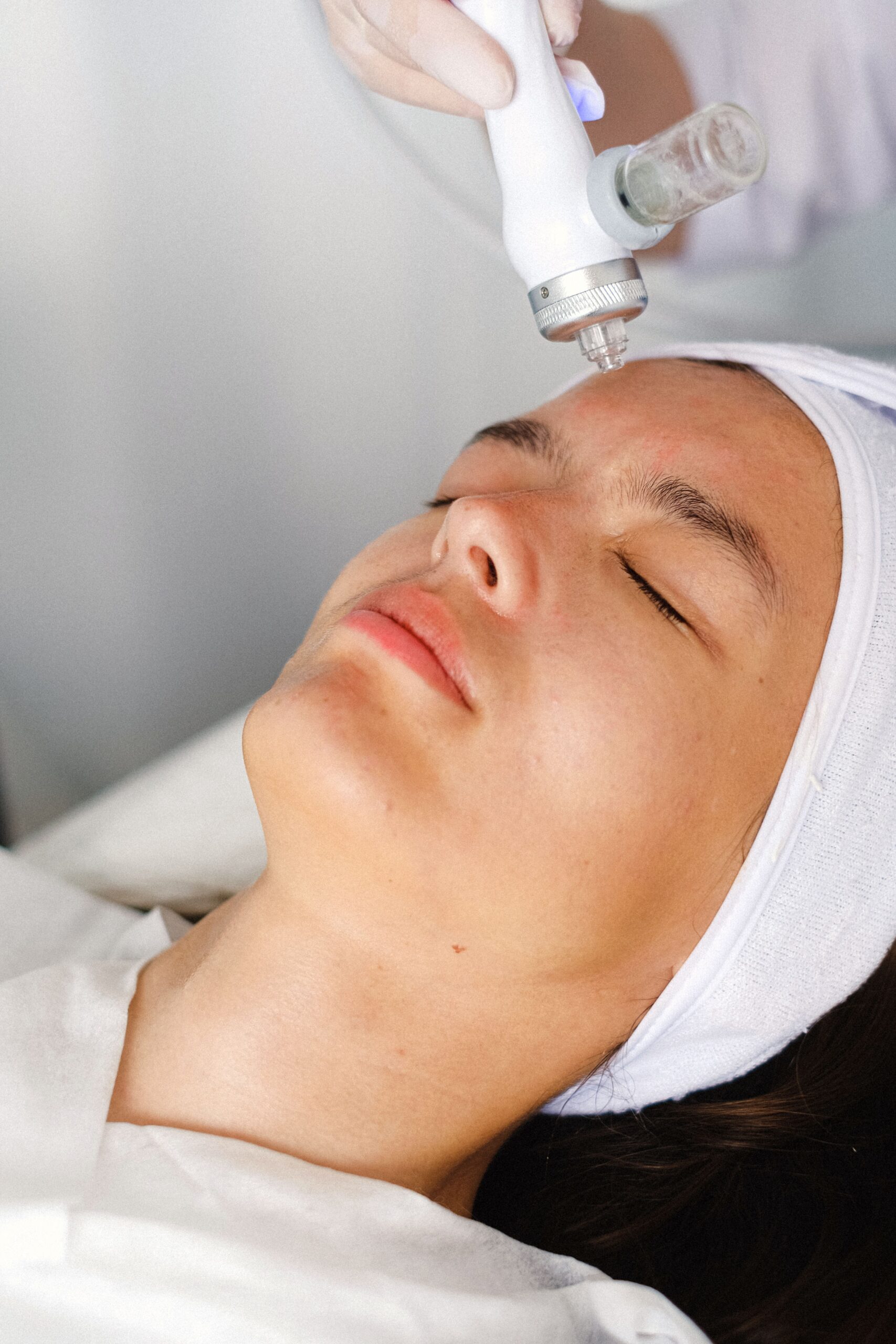 Microneedling Patient Woman at microneedling appointment